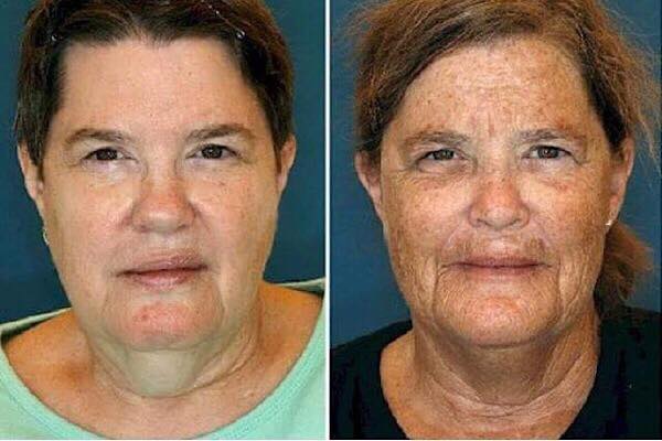 zdroj: viralgallerysite.com