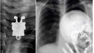 Zdroj : brightside.me