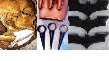 Zdroj : buzznick.com