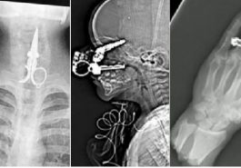 Zdroj : buzznick.com