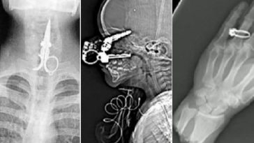 Zdroj : buzznick.com