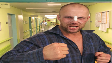 Bejrův zlomený nos